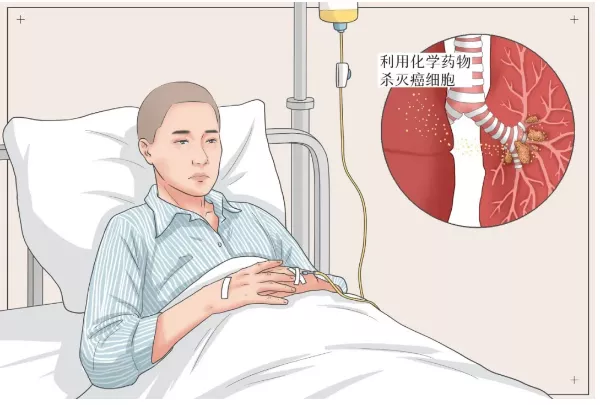 震撼的化疗到什么程度算是成功的照片